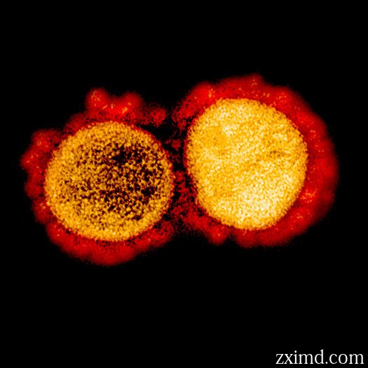 顯微鏡下的新型冠狀病毒COVID-19圖片