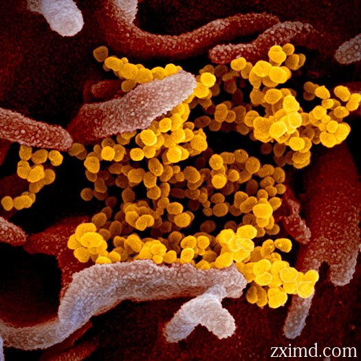 顯微鏡下的COVID-19圖片